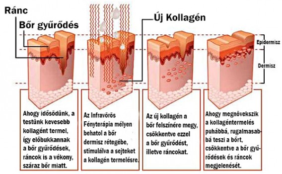 kollagén.fordítva